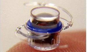 Un «minitelescopio» mejora la visión de pacientes con degeneración macular