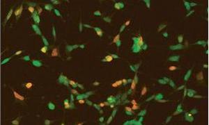 ¿Por qué los chimpancés no pueden hablar?