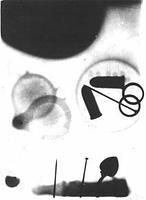 Así se hizo la primera radiografía de la historia