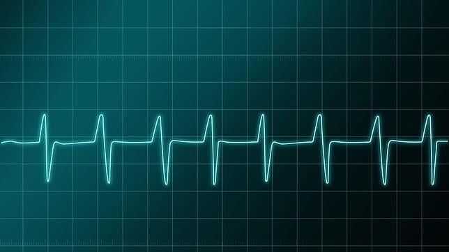 El hombre que permaneció sin pulso durante 96 minutos