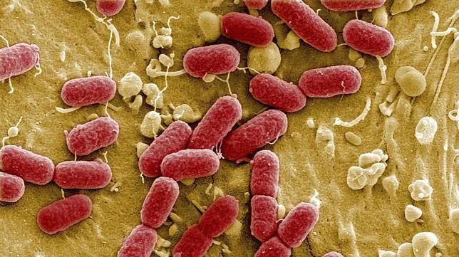 Significado dormitar Cilios Qué es Escherichia coli?: Todas los detalles sobre la bacteria de los  pepinos
