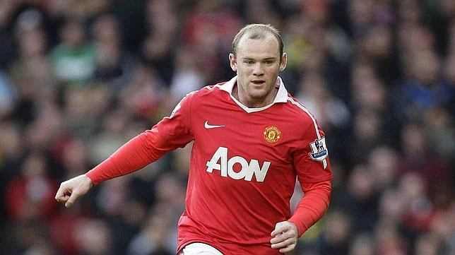 Wayney Rooney se somete a un trasplante de pelo