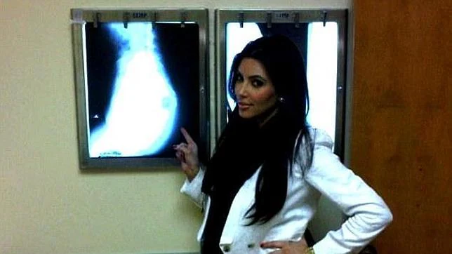 Kim Kardashian demuestra con una radiografía que su trasero es natural