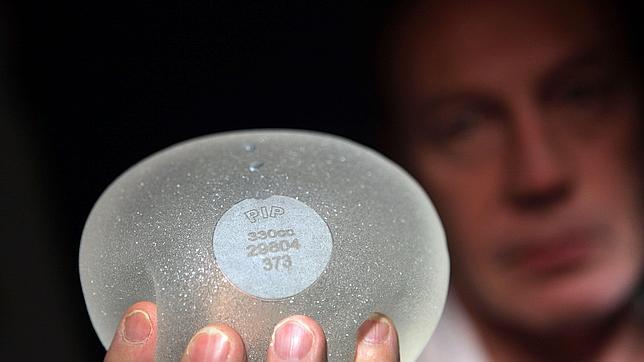 Francia recomienda a 30.000 mujeres que se retiren las prótesis mamarias por precaución