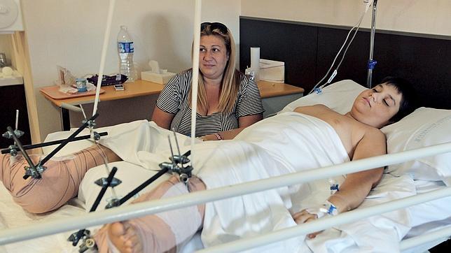 Cavadas reimplanta ambos pies a un niño de 10 años que caminará en seis meses