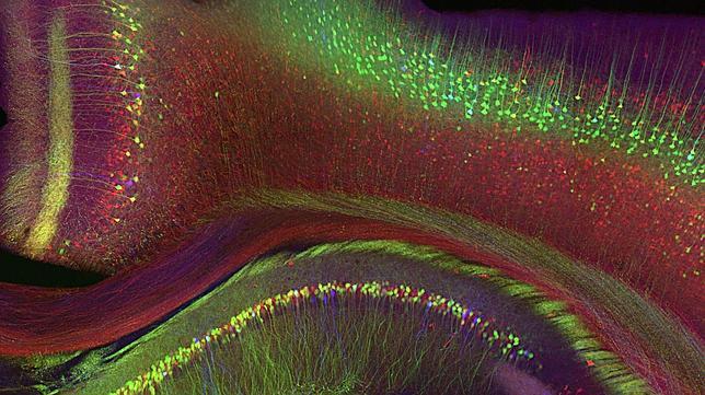 Logran borrar temporalmente recuerdos en ratones con un estímulo eléctrico en el cerebro