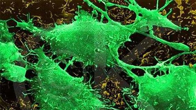 Avanzan modelos matemáticos para  describir el comportamiento de tumores