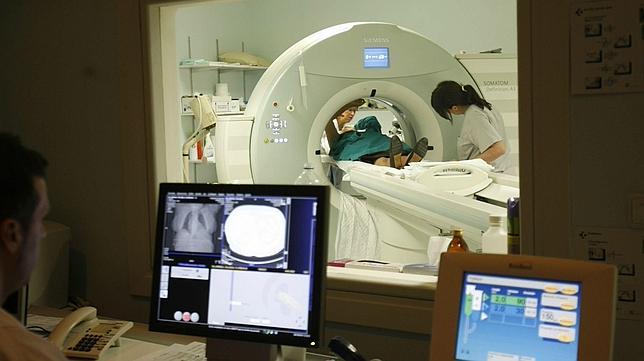 El estrés psicofísico aumenta el riesgo de padecer ictus
