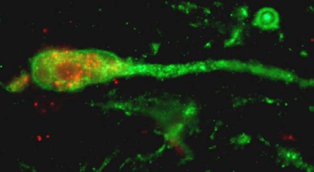 Descubren por qué el aislamiento social en la infancia causa trastornos psiquiátricos