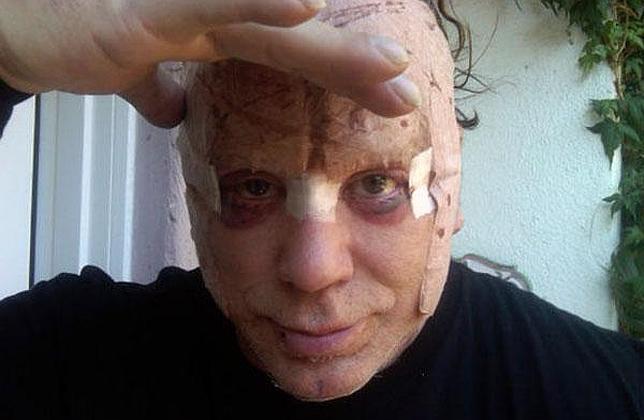 El nuevo rostro de Mickey Rourke