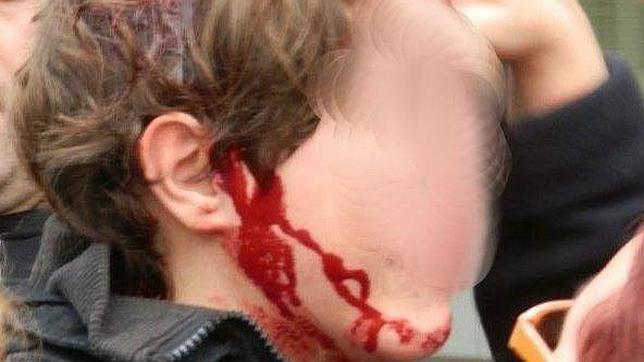La familia del menor herido por un golpe de porra en Tarragona denuncia el caso
