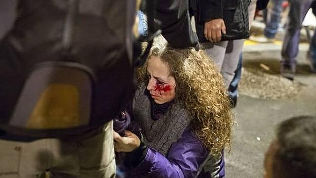 La mujer herida en el ojo en Barcelona durante el 14-N podría perder la visión