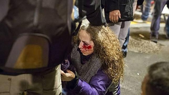 Los Mossos investigarán si la mujer que perdió la visión en un ojo recibió un disparo de proyectil
