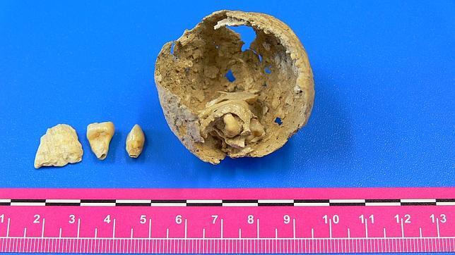 Una «catalana» de hace 1.600 años con dientes en los ovarios