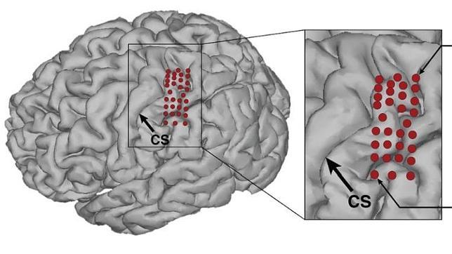 Un hombre paralizado mueve un brazo robótico con la mente y toca la mano de un amigo por primera vez