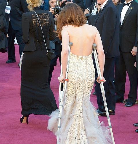 Con muletas desfiló Kristen Stewart por la alfombra (Foto: AFP)