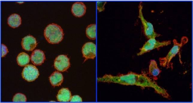 Un compuesto podría prevenir las recaídas en leucemia