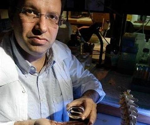 Huesos de repuesto fabricados a partir de la propia grasa