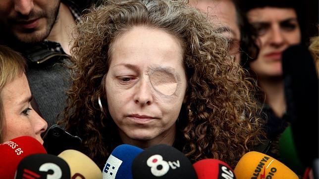 Cuatro mossos declaran que no vieron disparos donde una mujer perdió el ojo