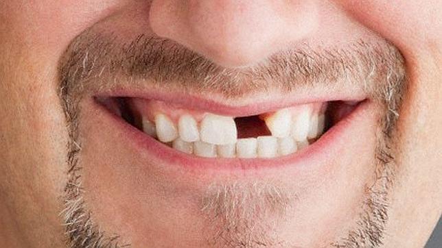 Las malas dentaduras que libran de la cárcel