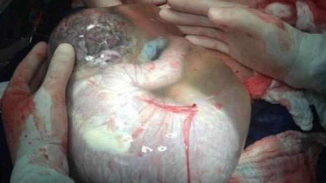 El bebé «que no sabía que había nacido»