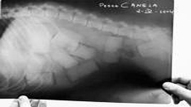 Radiografía del estómago de uno de los perros, bautizado «Canela» por su color