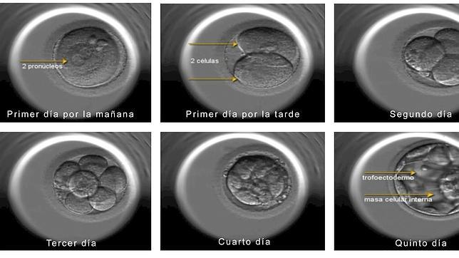 La música mejora la fecundación in vitro
