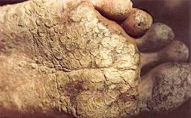 Una nueva herramienta detecta el agua contaminada sin análisis de laboratorio