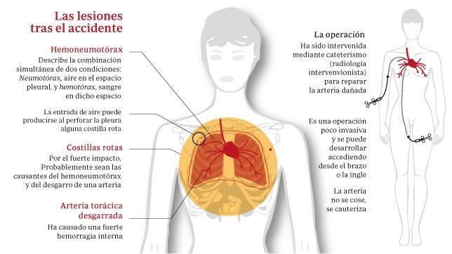 La hemorragia que pudo costarle la vida a  Cristina Cifuentes