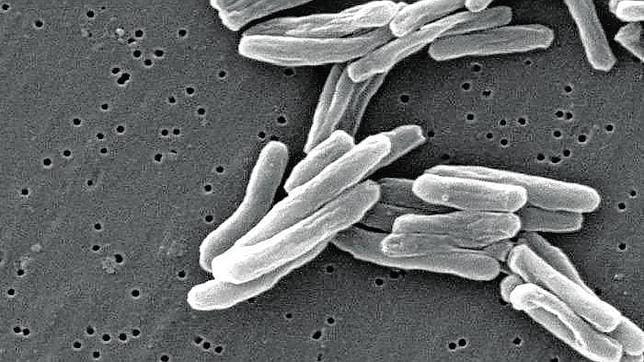 La tuberculosis se originó en África hace 70.000 años