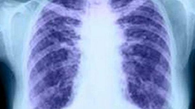 Investigadores proponen una nueva clasificación de los tipos de cáncer