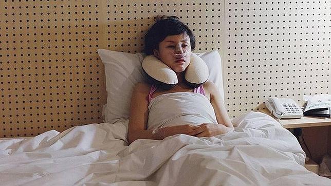 El precio de la cirugía estética: cicatrices y moratones para conseguir la belleza