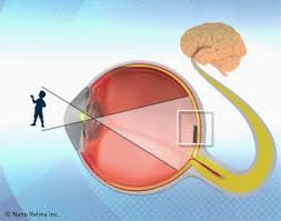 Un chip en el ojo devuelve la vista a los ciegos