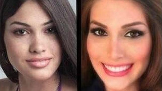 Miss Universo 2013 podría haberse operado la nariz