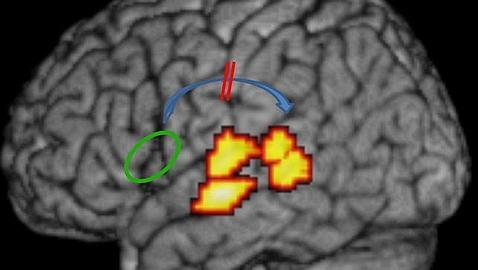 Desvelan las raíces de la dislexia