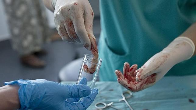 Un nuevo método de cultivo celular mejora los resultados del trasplante en cáncer