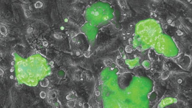 Investigadores de Barcelona descubren un método veloz de reprogramación celular