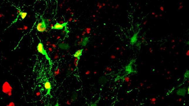 Reprograman células para que se conviertan en neuronas funcionales