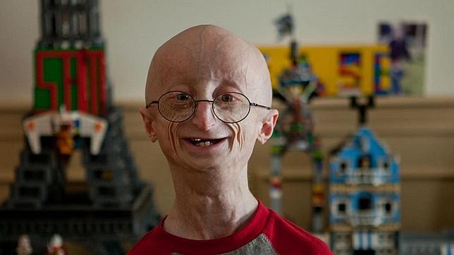Muere a los 17 años Sam Berns, el adolescente con cuerpo de anciano