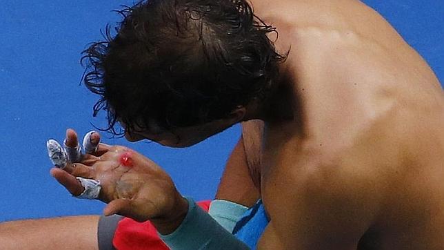 Nadal: «Si se me abre la mano, mi torneo está en peligro»