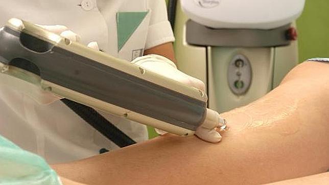 Depilación láser, paso a paso