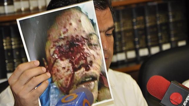 Denuncian en foros internacionales las torturas en Venezuela