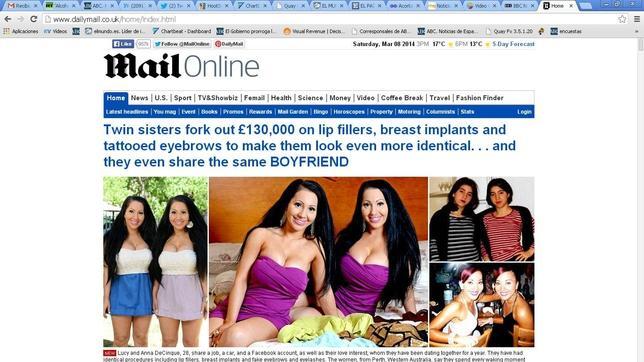 Las gemelas que comparten novio se gastan 160.000 euros para ser aún más idénticas