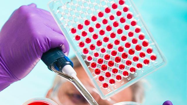 Un test sanguíneo detecta el alzhéimer con tres años de antelación y el 90% de precisión