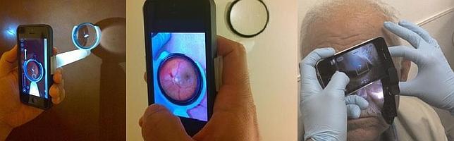 Utilizando el iPhone para analizar la retina