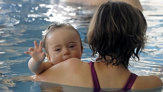 Desvelan cómo el cromosoma que provoca el síndrome de Down altera todo el genoma