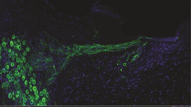 Un oído artificial para la sordera crónica