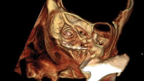 Cóclea del conejo restaurada