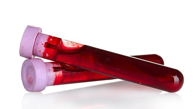 El elixir de la juventud podría estar en la sangre