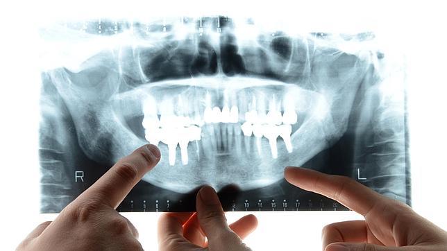 Las enfermedades periodontales: una amenaza silenciosa para nuestra salud